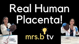 Real Human Placenta! 👀🤯