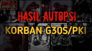 SANGAT MENYERAMKAN!!! HASIL AUTOPSI KORB4N PERISTIWA LUBANG BUAYA (G30S/PKI)!!!