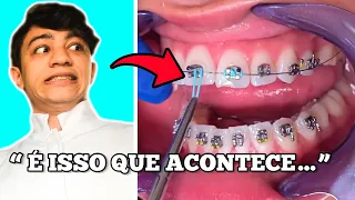 Como o Aparelho Dentário é colocado em você...