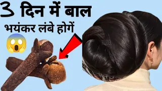 कसम से एक बार इसे लगाकर देखो बालों की लंबाई इतनी बढ़ेगी बस करवाते रहोगे,Cloves For Hair Growth