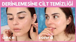 EVDE DERİNLEMESİNE CİLT TEMİZLİĞİ : Elveda Siyah ve Beyaz noktalar , Tıkalı gözenekler