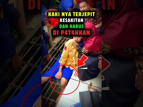 KESAKITAN KARNA KAKI NYA TER JEPIT!!