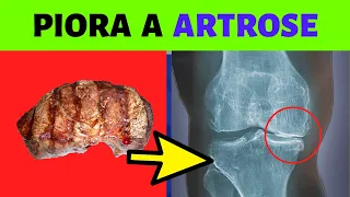 ARTRITE E ARTROSE - 3 ALIMENTOS QUE PODEM PIORAR SUAS DORES