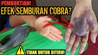 EFEK SEMBURAN COBRA JAWA! BAHAYA SEMBURAN ULAR ULAR COBRA! APAKAH BERBAHAYA JIKA KENA KULIT?