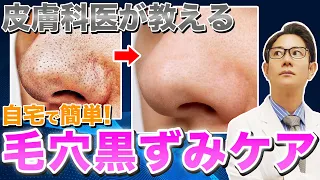 【いちご鼻撃退】自宅でできる！鼻の毛穴の黒ずみを治す方法
