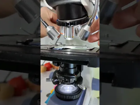 Unexpected bacterias through a microscope! #shorts #ytshorts #microscope #viral