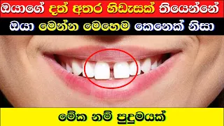 10 Surprising Things About You If You Have A Gap Between Your Front Teeth