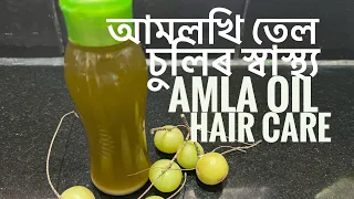 চুলি সৰিছে নেকি ব্যৱহাৰ কৰক আমলখি তেল | Amla Oil for Hair Care | It’s My Lifestyle