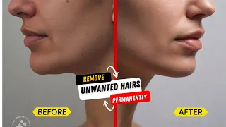 चेहरे पर अनचाहे बालों से कैसे छुटकारा पाएं