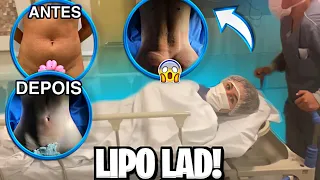 TUDO POR TRÁS DA MINHA LIPO LAD