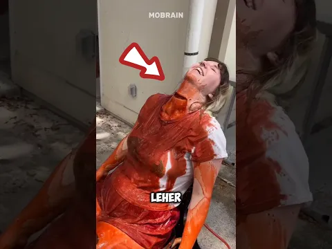 Viral‼️Lehernya terpotong tapi....😰#shorts #viralvideo #facts