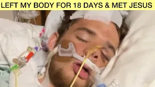 I Was Brain-Dead & Jesus Showed Me In Heaven How Prayer's Are Answered...