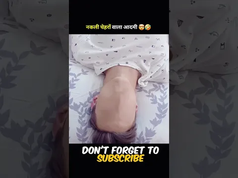 Boy Born Without a Face Wears a Different Mask Every Day 😶‍🌫️ #shorts
