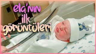 ELA'NIN DOĞUMU (İLK KEZ YÜZÜNÜ GÖRECEKSİNİZ)
