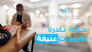 تشنجات عنيفة أصعب حالة يقوم بها الدكتور الريس في حياته المهنية