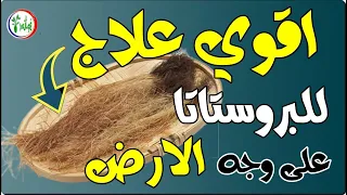 تضخم البروستاتا ـ بشرى سارة لجميع الرجال ـ علاج نهائي بإذن الله لالتهاب وتضخم البروستاتا مهما كان