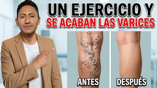Levanta las piernas todos los días! ¡Olvídate de la hinchazón, entumecimiento varices.