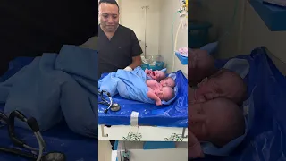 triplets baby born 2boy one girl