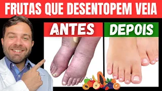 7 FRUTAS INCRÍVEIS para COMBATER MÁ CIRCULAÇÃO, VARIZES e DOR NAS PERNAS