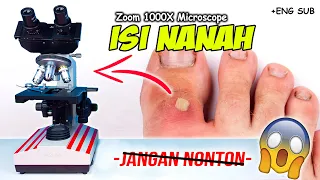 INILAH ISI NANAH DI MIKROSKOP | Pus Under Microscope Zoom 1000X