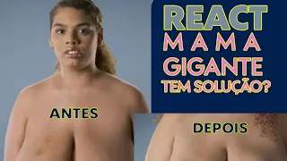 MAMOPLASTIA REDUTORA - MAMA GIGANTE