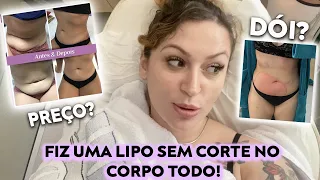 FIZ UMA LIPO SEM CORTES EM VÁRIAS PARTES DO CORPO! Valores, Pós, Dor e +!