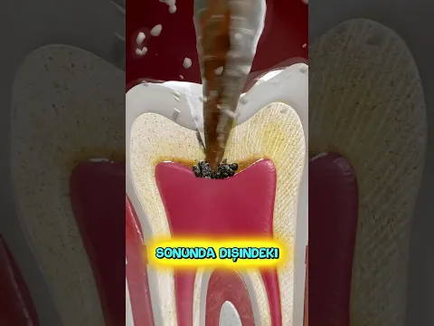 Eskiden Diş Tedavisi Böyleydi 😬⛏🤯