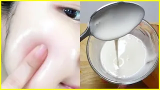 Cách Làm Trắng Da Mặt Tại Nhà Cho Học Sinh Mà Không Bắt Nắng Cực Hiệu Quả Bằng Sữa Không Đường
