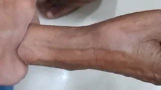 Cannulation.. long video.. part 06 #vigo #cannula