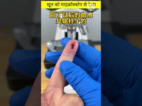 खून को माइक्रोस्कोप से देखने पर कितना ज्यादा डेंजरस लगता है #fact #short