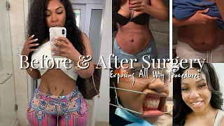 REVEALING ALL MY PRE-SURGERY PICS | WHAT ALL HAVE I DONE 🤔| Gina Jyneen