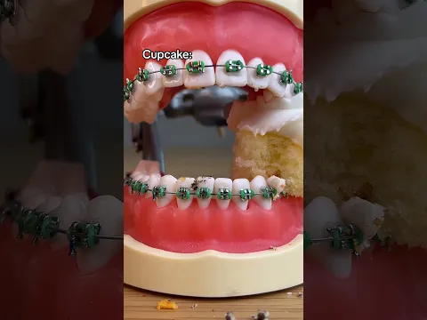 ¿Cuantos brackets tumbaste durante tu Ortodoncia?🫣 (insta: tudentistaideal) #shorts