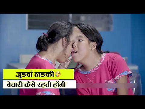 एक शरीर में दो लड़कियां 😱