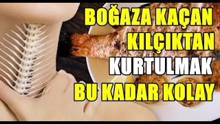 Boğaza kaçan balık kılçığı nasıl çıkar?