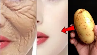 أقسم بالله حبة بطاطس واحدة ستخلصك من تجاعيد الوجه كأنك في20 من عمرك مجربة ومضمونة💯