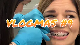 VLOGMAS #9 Andrea je skinula protezu! Kako vam se svidja??