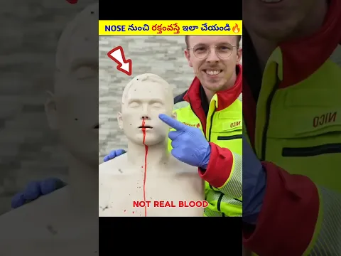 Learn How To Stop Nose Bleeding Quickly 🔥|#telugufacts #telugu #shorts #viralnews #viral