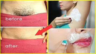 মাত্র ৫ মিনিটে যে কোন জায়গার অবাঞ্ছিত লোম চিরতরে দূর করুন, ব্যাথাহীন ঘরোয়া পদ্ধতিতে । Unwanted Hair