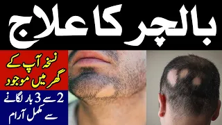 Balchar ka desi ilaj || How to treat Alopecia || Hakeem Zia Shahid