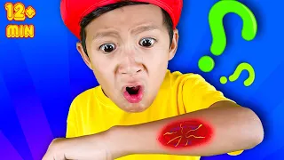 Por qué tenemos costras | Más Canciones Infantiles y Canciones Infantiles