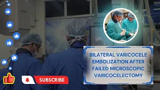 Bilateral Varicocele Embolization After Failed Microscopic Varicocelectomy | IRFACILITIES