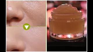 MAGICAL OVERNIGHT Treatment to REPAIR Damaged Skin, Dark SPOTS, Open PORES