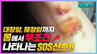 암 초기에 몸이 보내는 SOS 신호! 암이 있으면 무조건 나타나는 증상들 꼭 알아 두세요