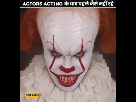 ऐसे Actors जो Acting के बाद पहले जैसे नहीं रहे 😱 | #shorts #acting