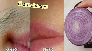 تخلصي نهائيا من شعر الوجه، الجسم والعانة، سيسقط الشعر لوحده ولن ينبت مجددا، مسحة واحدة وسيختفي الشعر