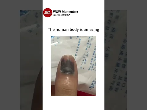 The human body is amazing