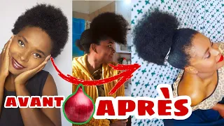 POUSSER SES CHEVEUX PLUS VITE JUSTE EN 2 SEMAINES AVEC L'OIGNON CONCENTRÉ