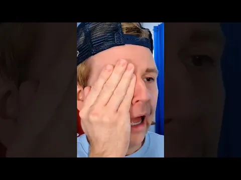 EYEBALL JOKE GONE WRONG! #shorts