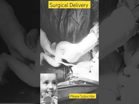 Surgical Baby Delivery | Charming Baby Girl Born #Surgicaldelivery #Babygirlborn