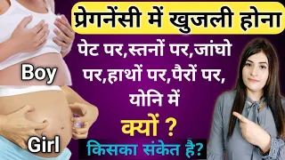 प्रेगनेंसी में खुजली क्यों होती है? | Itching During Pregnancy @ReshusVlogs @ReshuBabyCare
